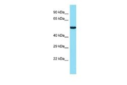 ANKRD34B Rabbit anti-Human, Polyclonal, Novus Biologicals 0.1 mL | Buy Online | Novus Biologicals | Fisher Scientific